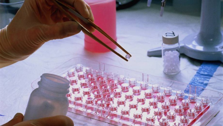 Photo©Eurobiomed Photo©Eurobiomed