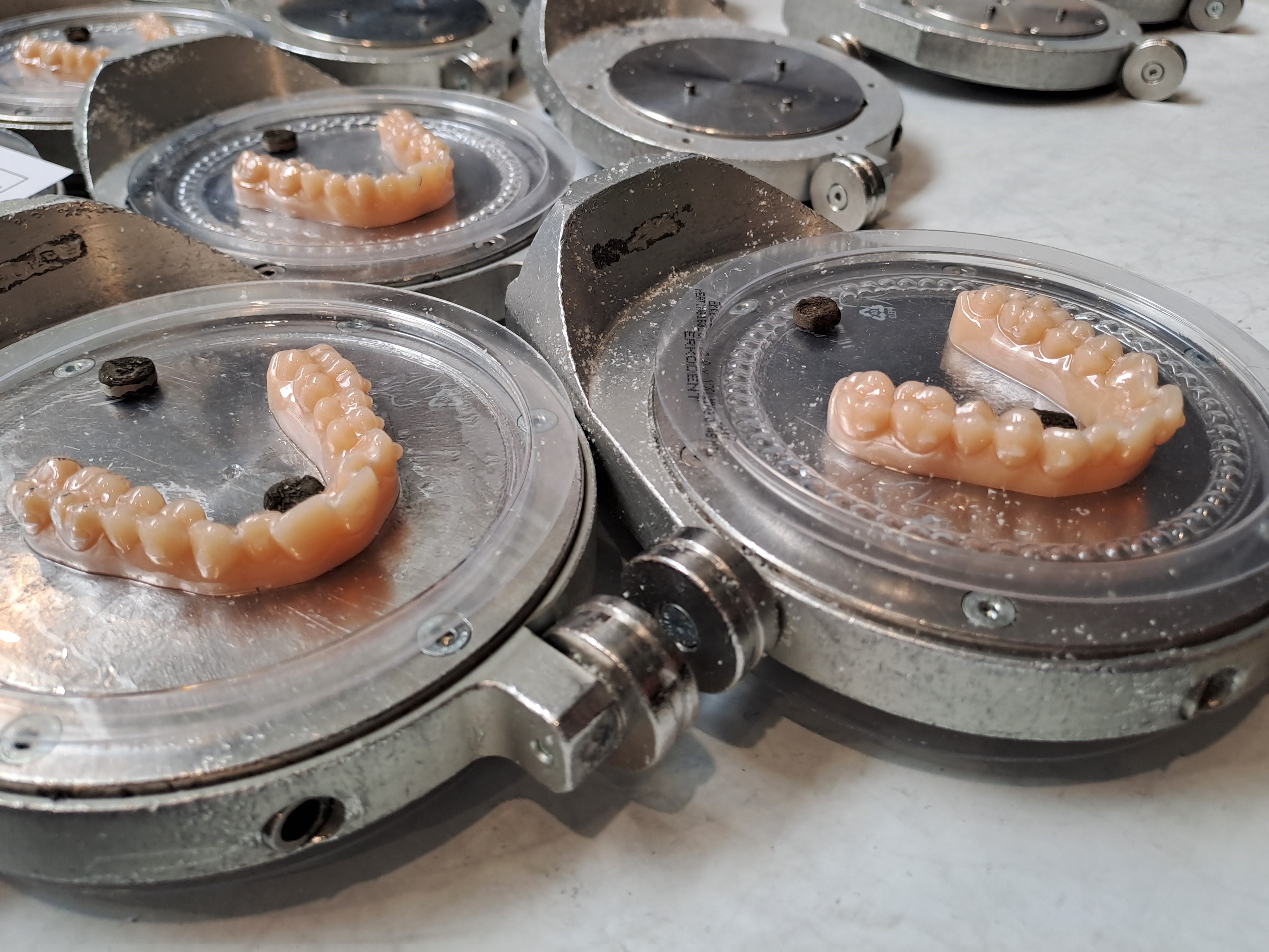 Smilers produit l'intégralité des gouttières pour le traitement d'alignement des dentitions (photo JC Barla)